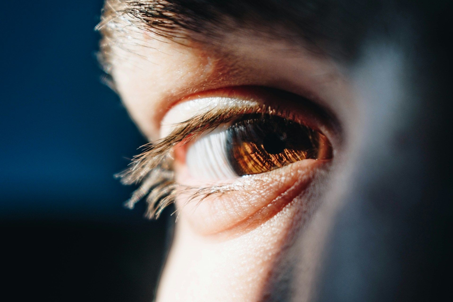 lasik